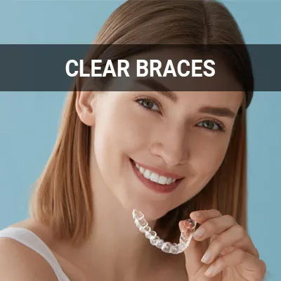 What It Feels Like to Have Clear Braces as an Adult - Chesterfield Dentist  Chester Virginia