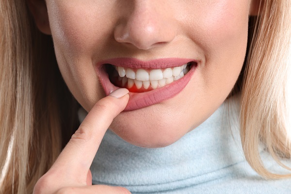 How A Family Dentist Checks For Gum Disease At A Dental Check Up